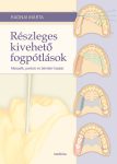 Részleges kivehető fogpótlások 2. kiadás